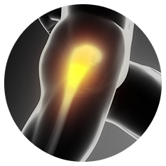 Hip pain & conditions